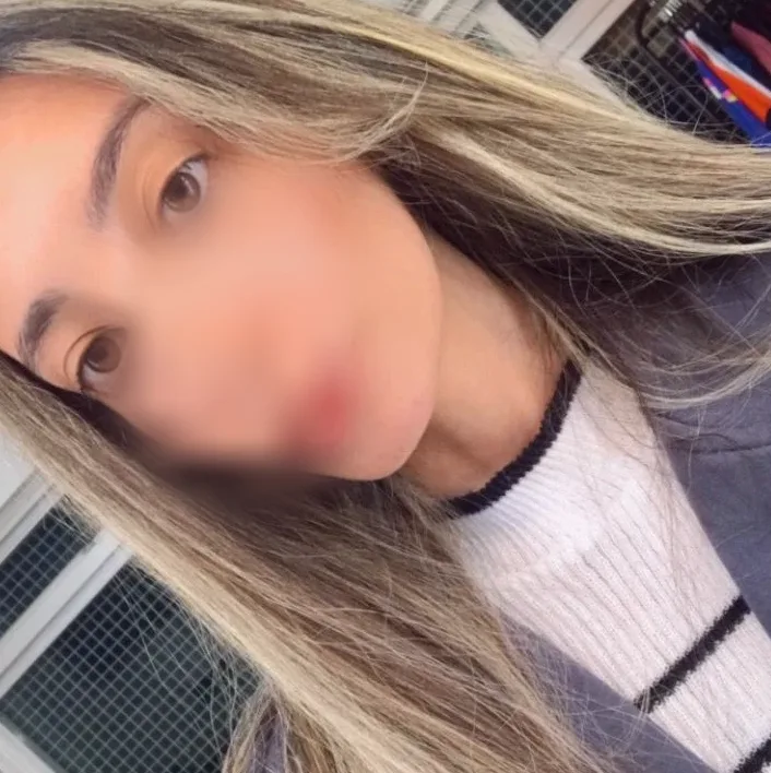 Esmee, 20